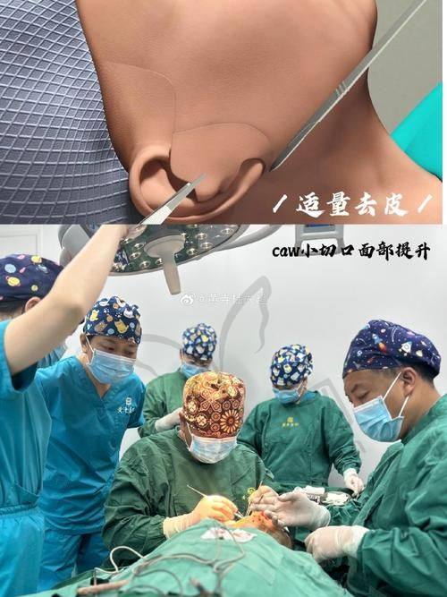 六、北京小拉皮优质医院推荐——北京冰新丽格医疗美容