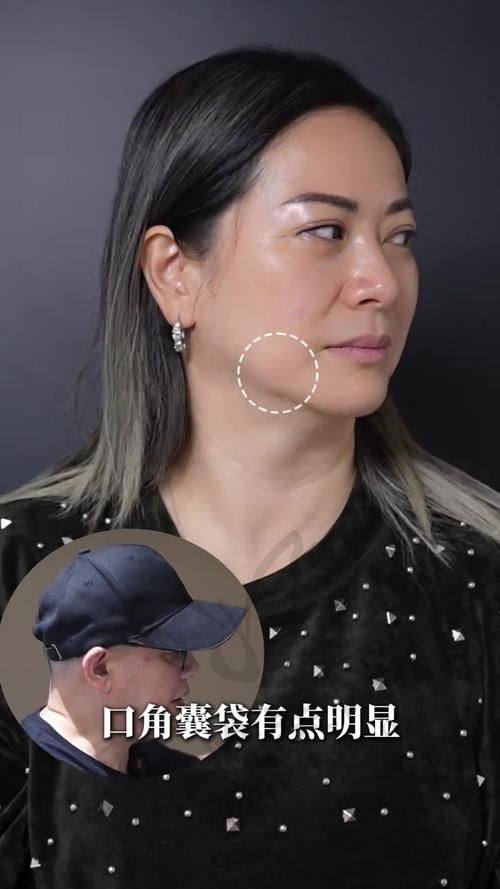 擅长领域：上海王洪医生精细施治重塑美丽