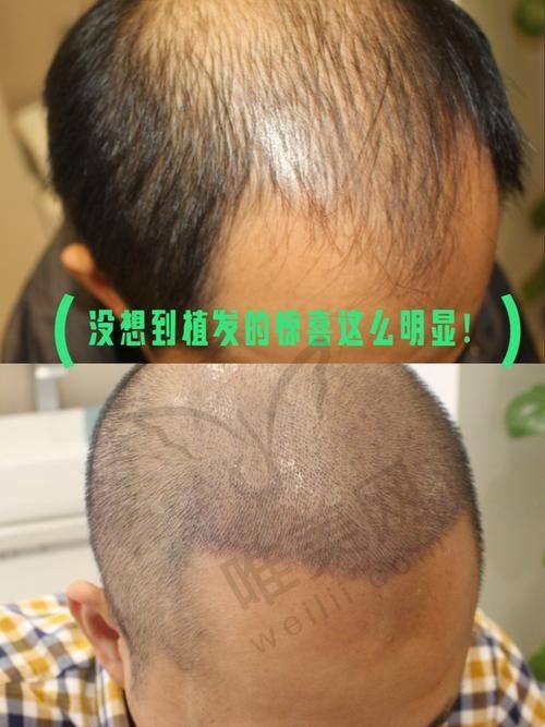 北京大麦微针植发基本信息