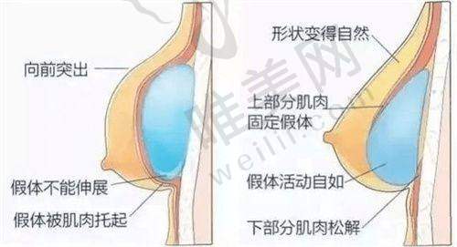 总结