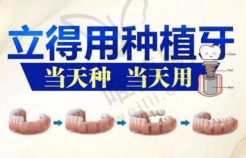 2025铜仁种植牙价格总览