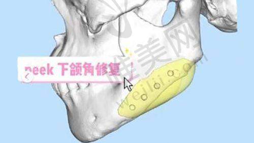 价目表公开，李世荣整形医院收费透明合理