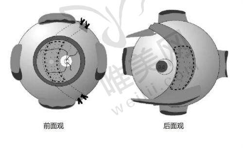 山西省眼科医院近视手术预约挂号方式