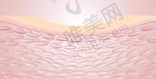 打胶原蛋白替代方案