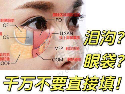 厦门泪沟填充十大正规医院推荐