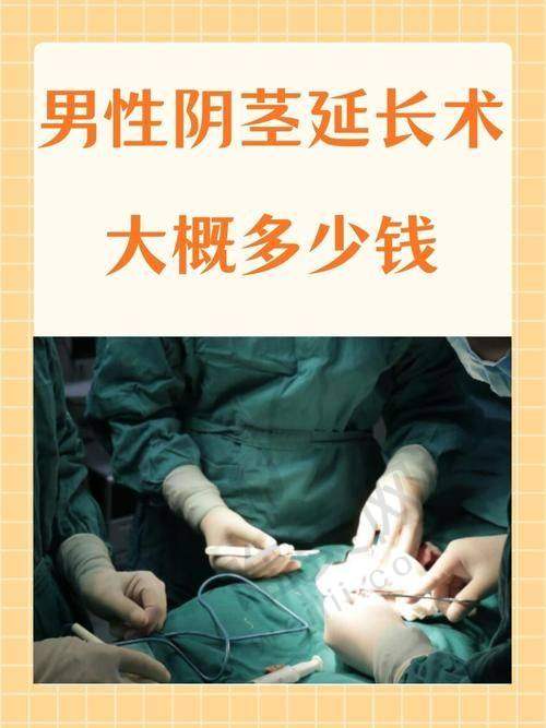 行业对比优势：李世荣阴茎延长术数据与技术的双重领跑