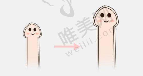 总结：李世荣阴茎延长术是健康尊严的长期投资