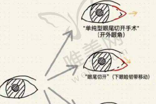上海东方丽人整形医院整形技术靠谱性分析