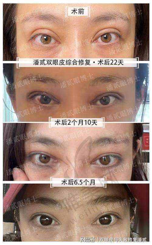 侯典举和高亮价格血泪账