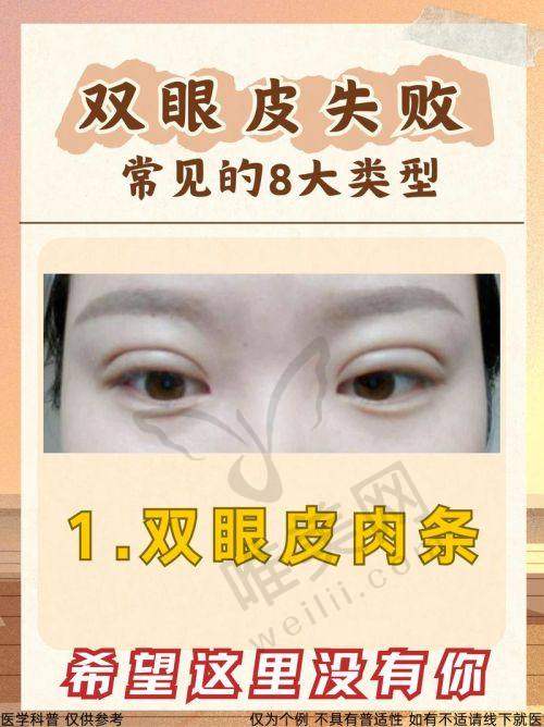 侯典举和高亮技术硬核PK
