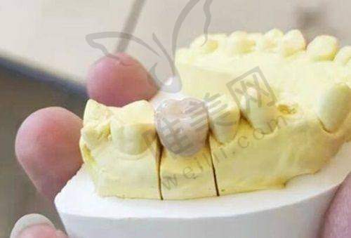 9、潍坊华贝口腔门诊部真人口碑评价怎么样？