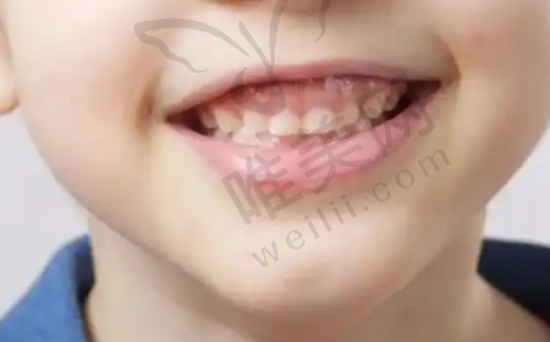 2、广州曙光口腔医院是正规医院吗？
