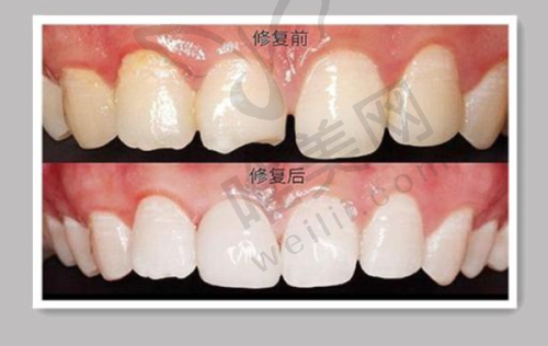 8、南宁牙典口腔门诊（昌泰店）详细的预约挂号方式及流程