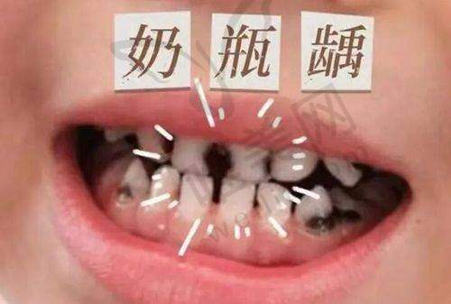 8、安阳悦尔口腔门诊部详细的预约挂号方式及流程