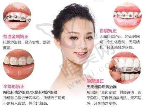 3、温州永嘉肖尔口腔简介概述