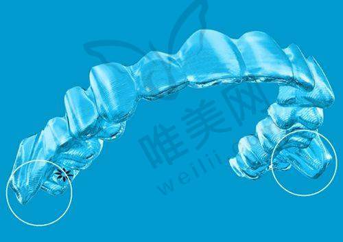 4、西昌春城口腔门诊部特色项目及技术优势
