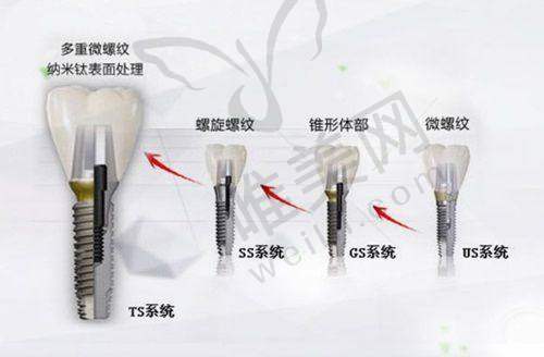 4、石家庄全博口腔医院（全博儿童口腔门诊部）特色项目及技术优势