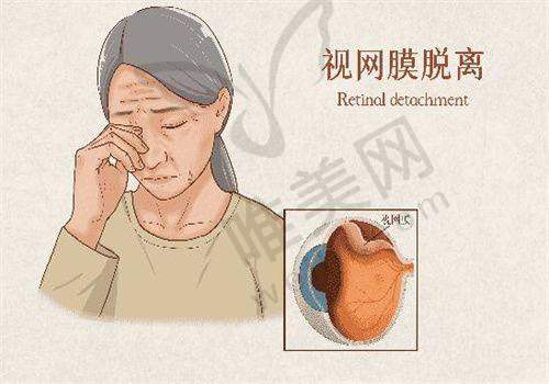 嘉兴爱尔眼科是私立医院吗？是私立医院，但和公办医院一样正规靠谱——精良设备支持
