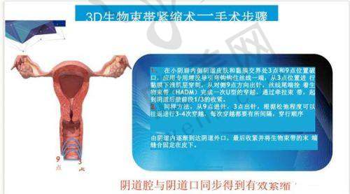 9、北京圣嘉荣医疗美容医院真人口碑评价怎么样？