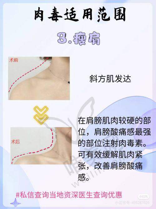 9、北京五维医疗美容医院真人口碑评价怎么样？