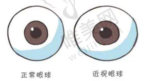 嘉兴爱尔眼科是私立医院吗？是私立医院，但和公办医院一样正规靠谱——患者评价见证