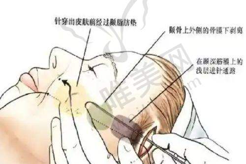 5、北京鹏爱海悦星光医疗美容诊所医生团队实力强大及骨干医生简介