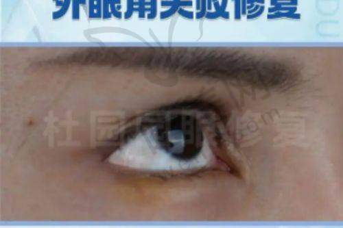 8、北京卓彦医疗美容诊所详细的预约挂号方式及流程