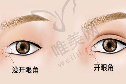 6、北京星美幻眼医疗美容诊所有限职责公司收费价格表/收费标准