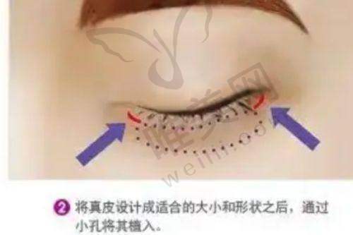 长沙雅美整形田芳斌怎么预约?电话预约便捷效率高