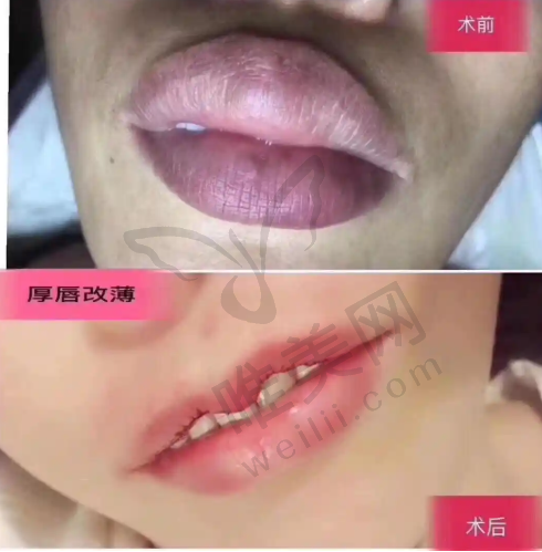 2、佳木斯王紫薇医疗美容诊所是正规医院吗？