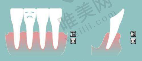 9、保定京都整形医院真人口碑评价怎么样？