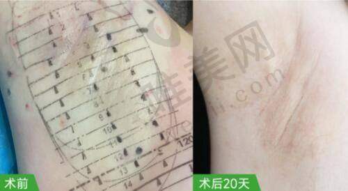 4、广州佳俪医疗美容门诊部特色项目及技术优势
