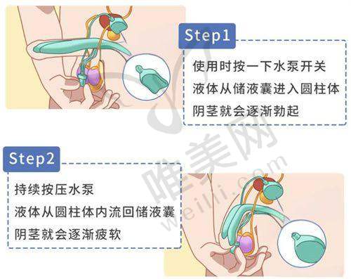 4、北京芙艾医疗美容门诊部特色项目及技术优势