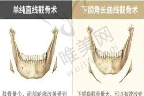 4、徐州美意针医疗美容门诊部特色项目及技术优势