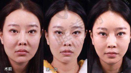 2、郑州张朝蕾医疗美容门诊部是正规医院吗？