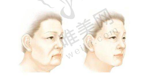 8、鞍山任凌莘医疗美容中医诊所详细的预约挂号方式及流程