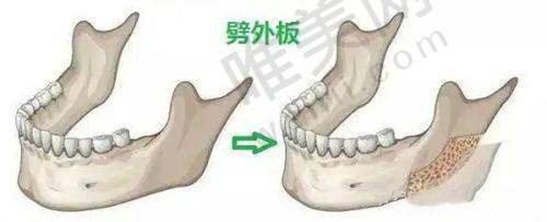 李在郁医生在哪家医院出诊?揭晓北京漾格李在郁医生治疗实例与医院服务特色