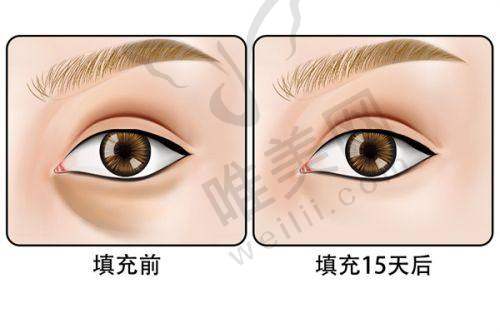 9、鞍山冯少旭医疗美容诊所真人口碑评价怎么样？