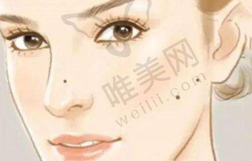 2、成都高新春天医疗美容整形门诊部是正规医院吗?