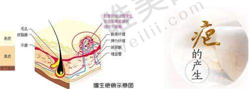 2、北京星美幻眼医疗美容诊所有限职责公司是正规医院吗？
