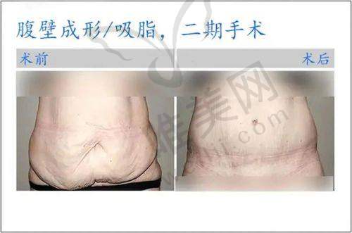 4、安阳婷琪医疗美容诊所特色项目及技术优势