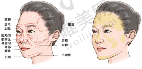 4、佳木斯王紫薇医疗美容诊所特色项目及技术优势