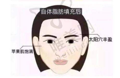 4、上海悦颜医疗美容门诊部特色项目及技术优势