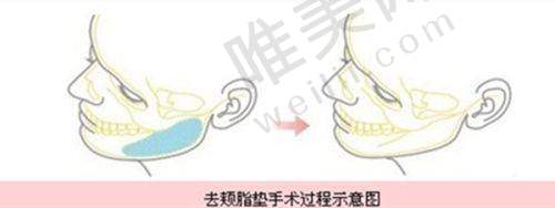 6、安阳五官医院整形美容诊所收费价格表/收费标准