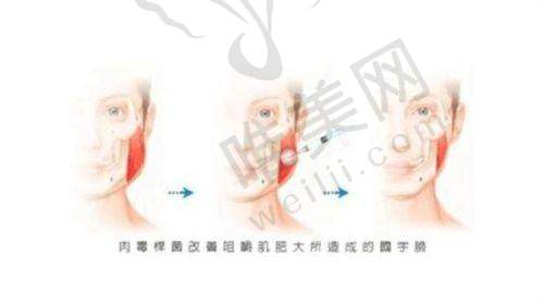 2、北京鹏爱海悦星光医疗美容诊所是正规医院吗？