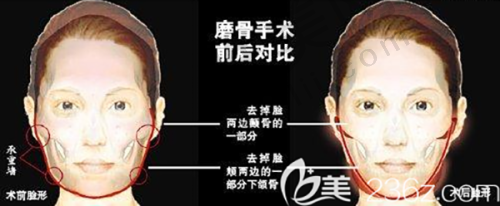 7、北京美邦医疗整形美容诊所地址电话营业时间