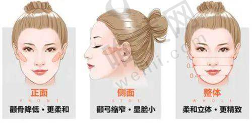北京私密整形去哪家医院好?北京嘉禾私密手术做得不错且价格不贵——北京嘉禾侯智慧医生的缩阴技术优势
