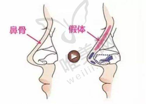 2、北京卓彦医疗美容诊所是正规医院吗？