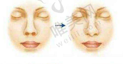 9、北京空美圣医医疗美容门诊部真人口碑评价怎么样？