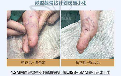 2、郑州第二中医院是正规医院吗？